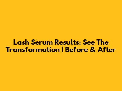Lash Serum Results: See The Transformation | Before & After